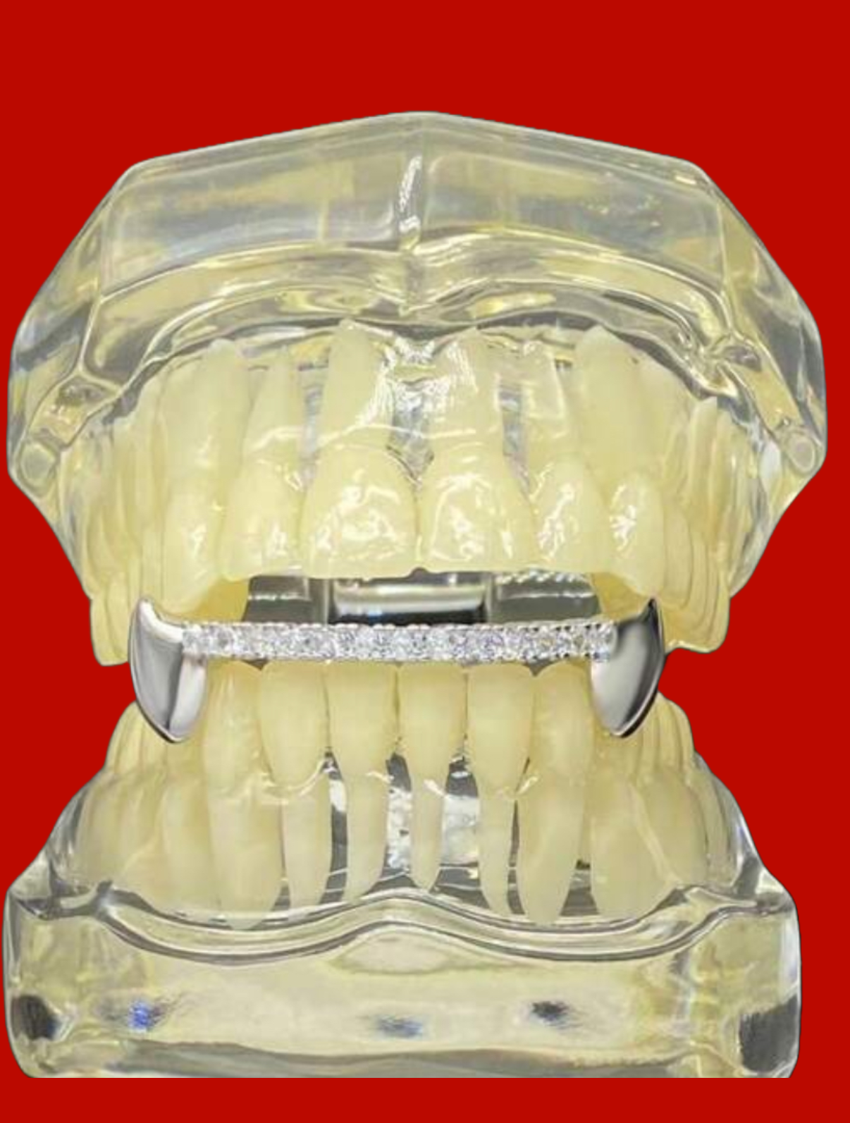 Royal Line – Grills Full Strass sur base dorée